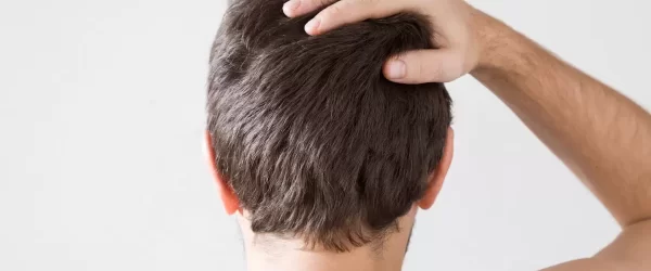 Come curare i capelli secchi e danneggiati