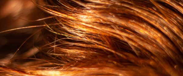 Ecco le 5 cause della caduta dei capelli